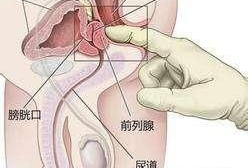 前列腺按摩视频,专业视频解析与操作指南